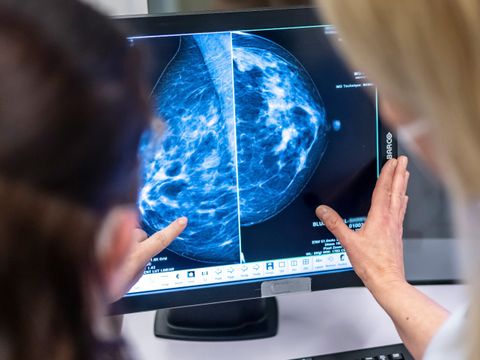 Ärztin und Patientin beim Mammographie-Screening