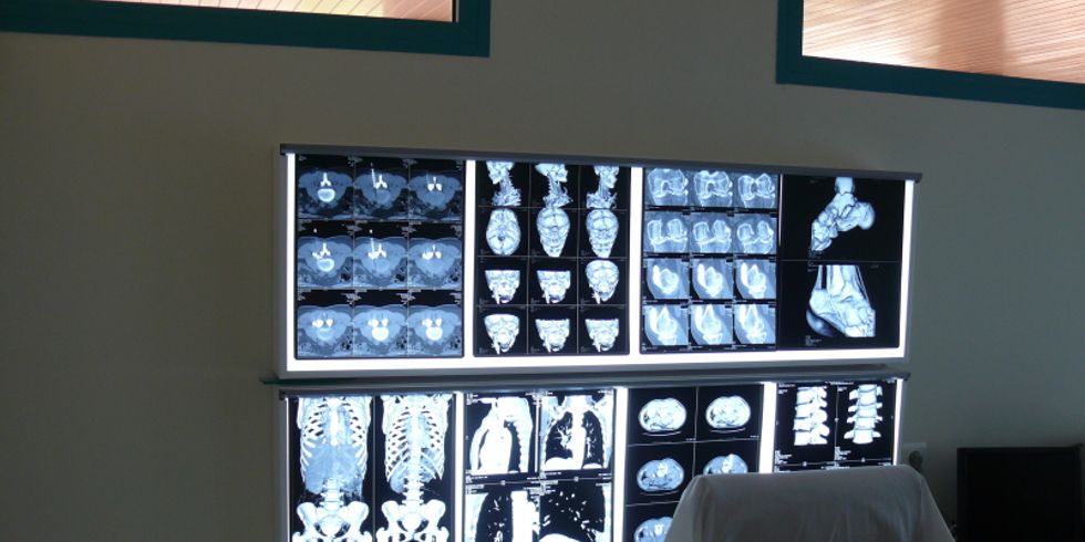 Verschiedene medizinische Röntgenbilder (Computertomografie)