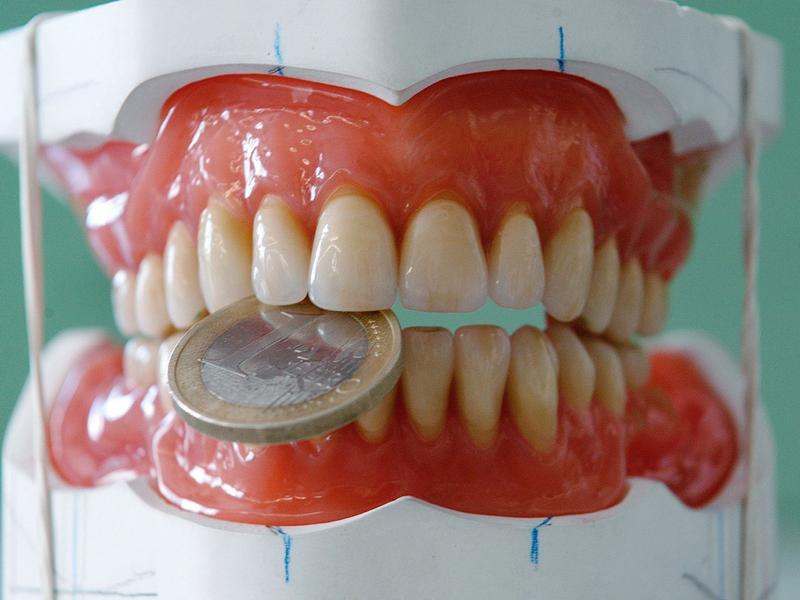 Zahnfullungen Wie Lange Halten Gold Inlays Amalgam Und Co