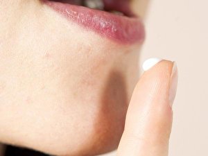 Mund herpes heilt nicht am Lippenherpes schnell