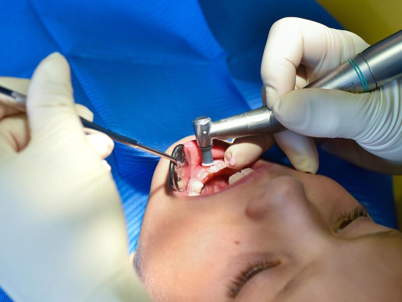 Loch im Zahn: Kein Amalgam mehr für Kinder und Schwangere ...