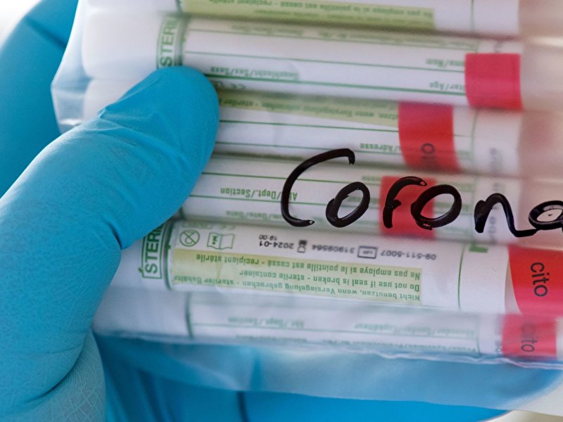 Zahl bestätigter Corona-Fälle erreicht fast 9700