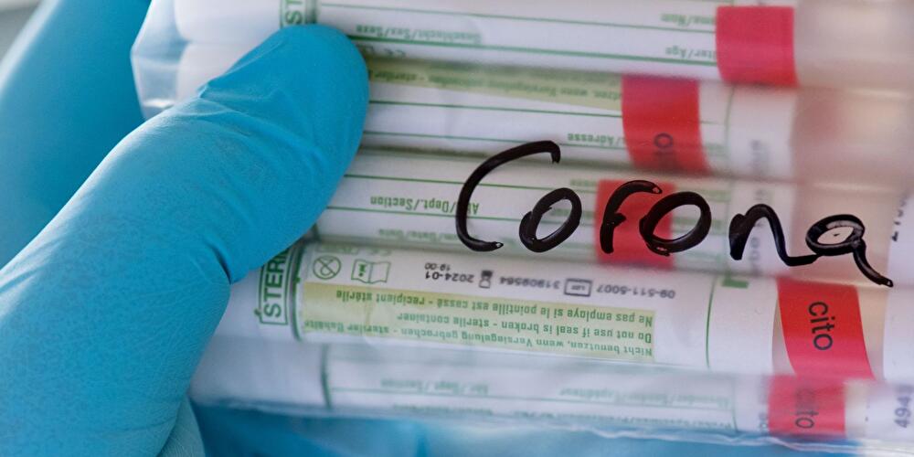 Corona-Tests