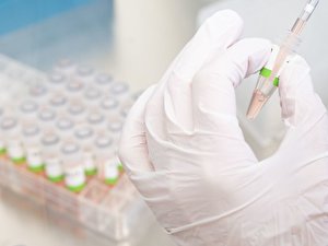 Eine biologisch-technische Assistentin bereitet PCR-Tests vor