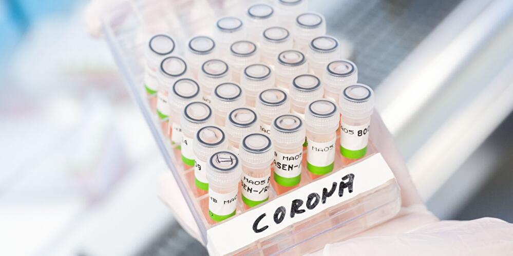 Gefäß mit aufbereiteten PCR-Tests auf das Coronavirus