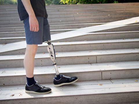 ein Mann mit Beinprothese steht auf einer Treppe im Freien