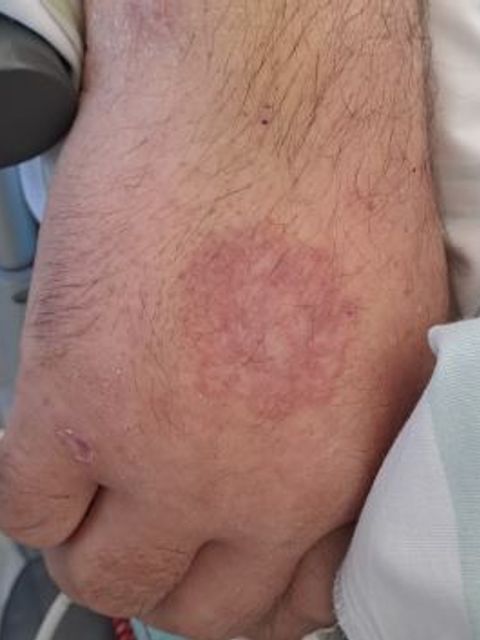 Hand des unbekannten Mannes