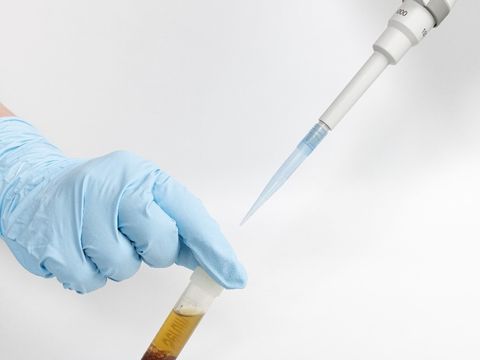 Untersuchung von Körperflüssigkeiten