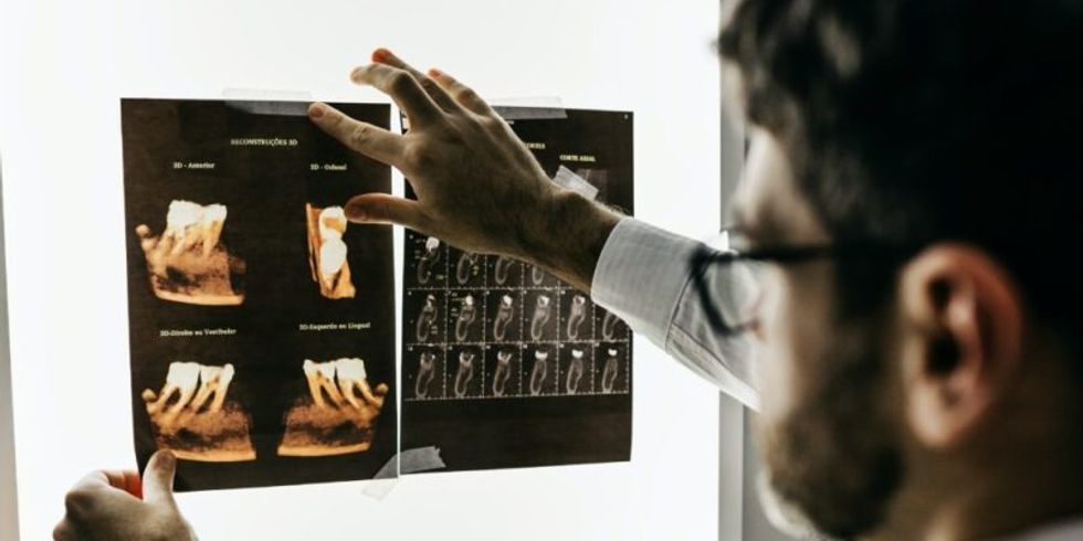 Ein Zahnarzt schaut sich ein Röntgenbild an