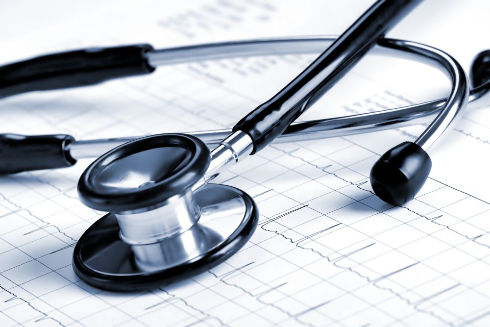 Stethoskop liegt auf einem EKG-Auszug