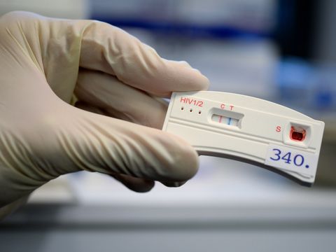 HIV-Test