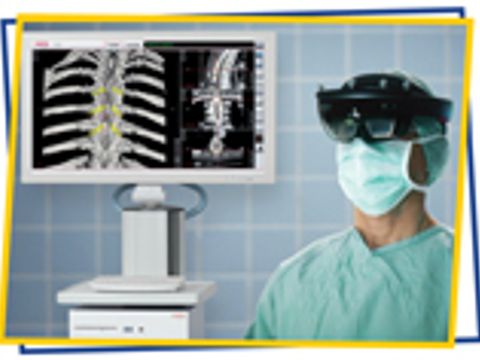 Scopis Holographic Navigation Platform