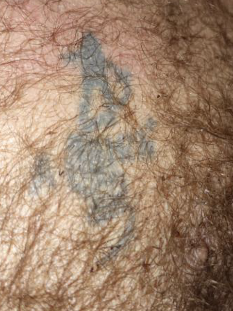 Tattoo des unbekannten Toten