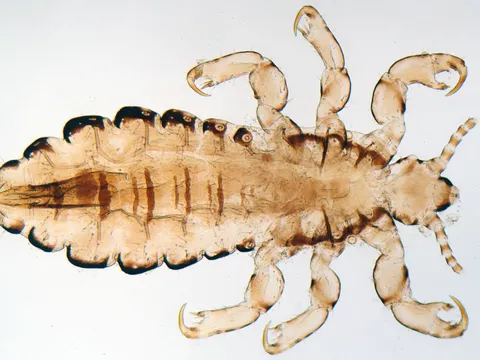 Kopflaus