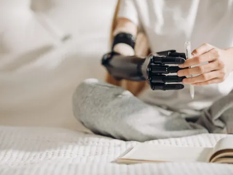 Frau hält mit beiden Händen einen Stift, sie trägt rechts eine Armprothese