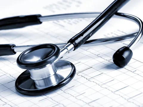 Stethoskop liegt auf einem EKG-Auszug