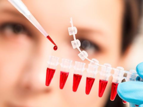 Laboratin entnimmt mit einer Pipette Blut aus einem Reagenzgläschen