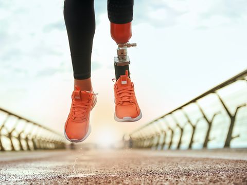 Never give up Cropped photo of disabled woman with prosthetic leg in sportswear jumping on the bridge