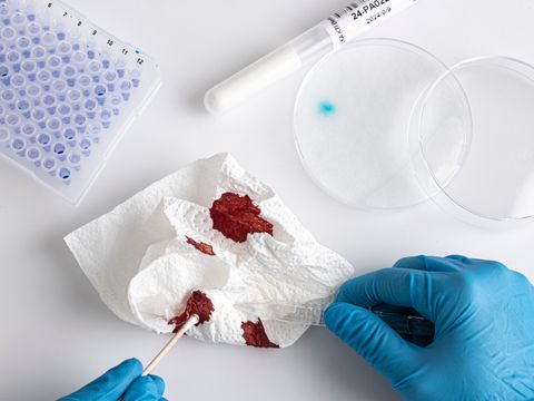 KTI 6 DNA Probe