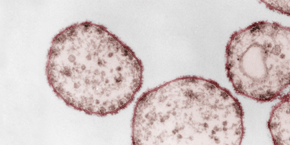 Masernvirus (Paramyxoviren), Transmissions-Elektronenmikroskopie, Ultradünnschnitt. Maßstab = 200 nm