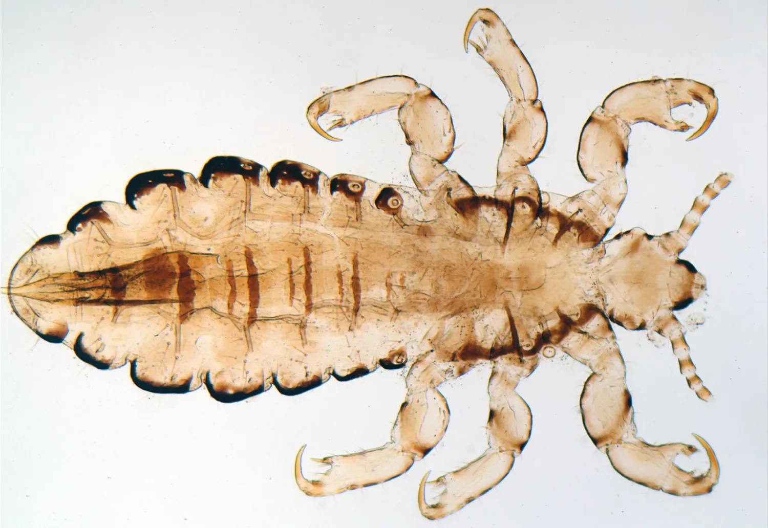 Kopflaus