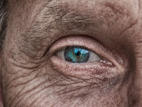 Auge eines Rentners