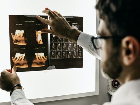 Ein Zahnarzt schaut sich ein Röntgenbild an