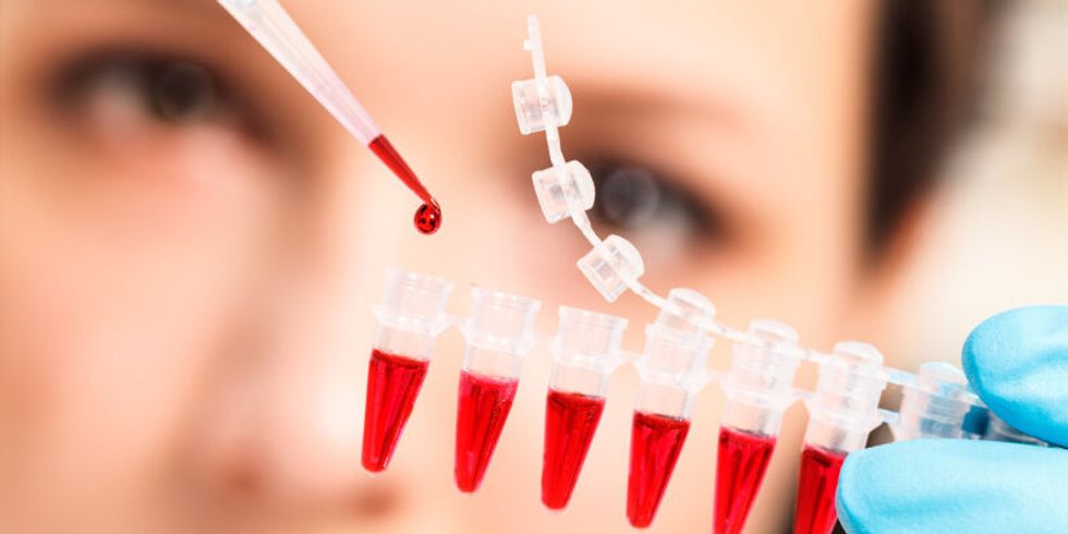Laboratin entnimmt mit einer Pipette Blut aus einem Reagenzgläschen