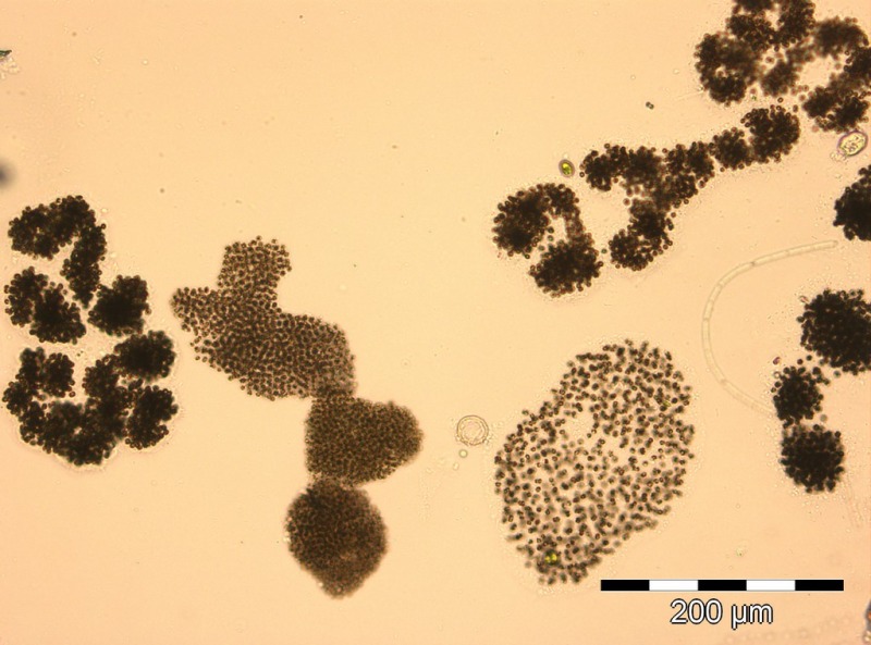 Microcystis flosaquae viridis aeruginosa